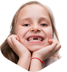 Broken  Teeth treatment in children kerala